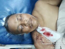 Adi Prayetno Tewas Dirampok di Jalan AH Nasution Medan