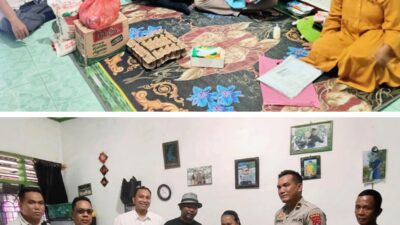Pemkab dan Polres Sergai Bantu Balita Hidrosepalus