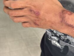 Kawanan Begal Bacok Pengendara  Sepeda Motor