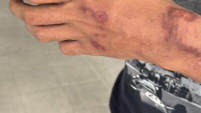 Kawanan Begal Bacok Pengendara  Sepeda Motor