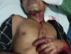 Diduga Dendam, Pria di Medan Deli Nyaris Tewas Dibacok